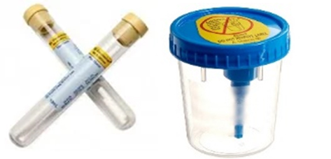 Urine Cup with Vacutainer